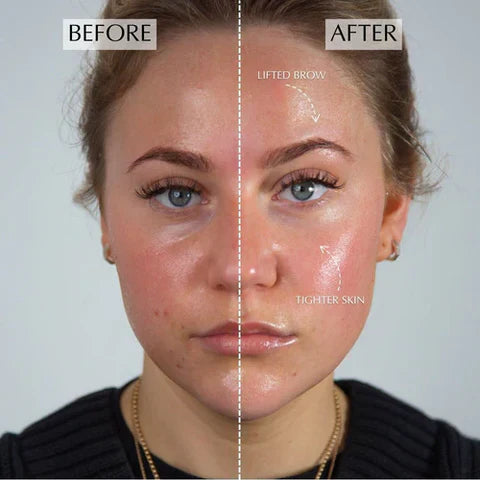 3-in-1 Anti-Aging Face Massager